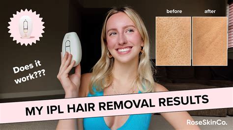 lumi ipl review|lumi ipl hair removal review : r/HairRemoval